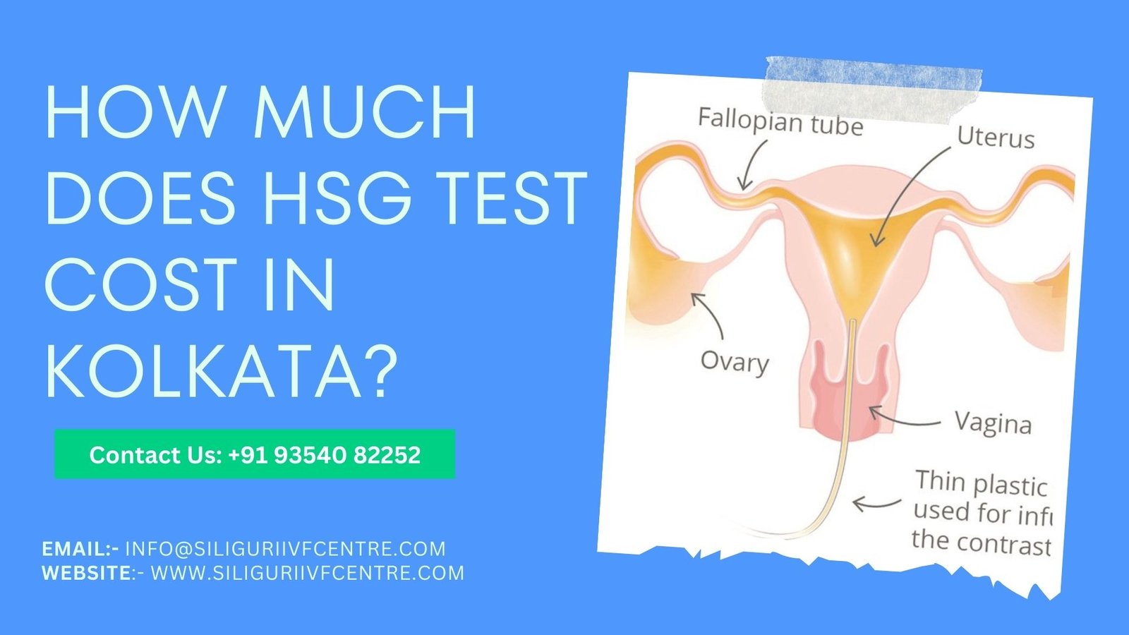 HSG test cost in Kolkata