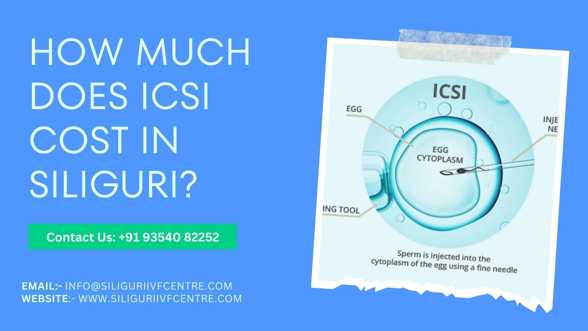 ICSI Cost in Siliguri