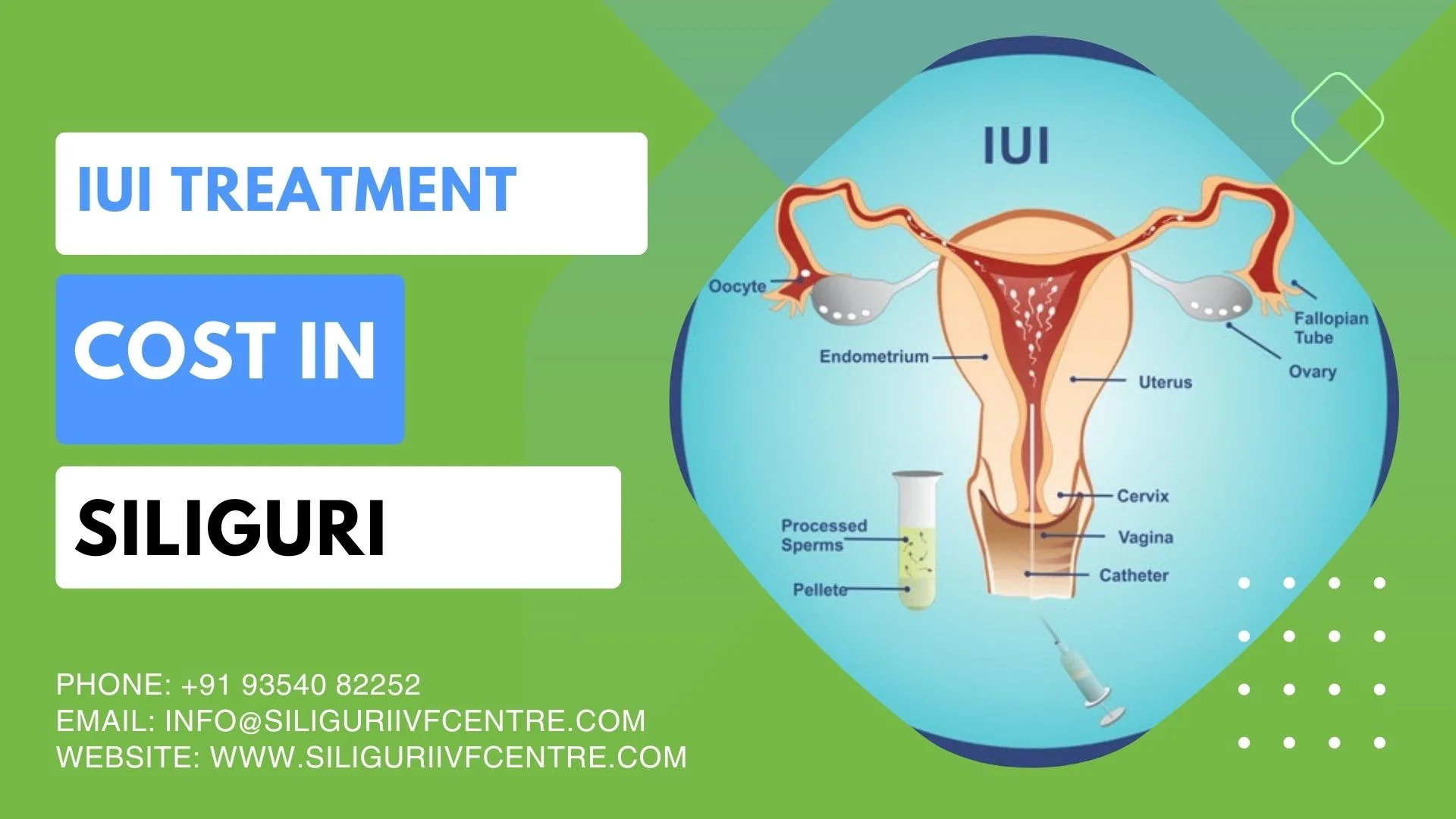 IUI Cost in Siliguri
