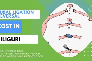 Tubal Ligation Reversal Cost in Siliguri